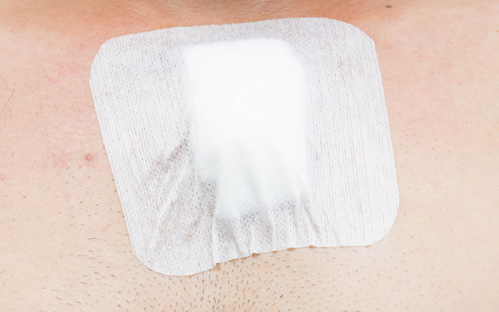 When and How to Use Chest Seals Survival Daily